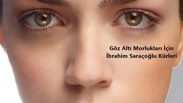 İbrahim Saraçoğlu Göz Altı Morlukları Nasıl Geçer Doğal Çözüm Önerileri?